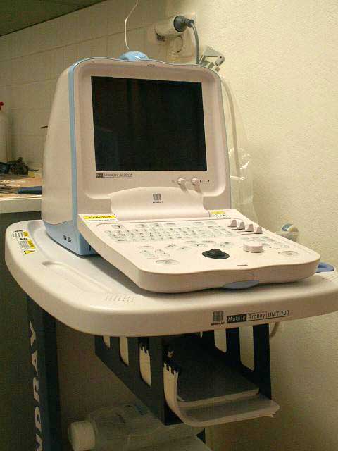 ultrazvuk